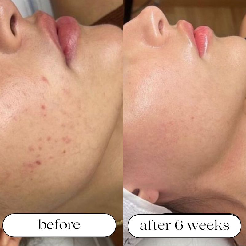 DwellWell™ 7-Mode LED Light Therapy Mask