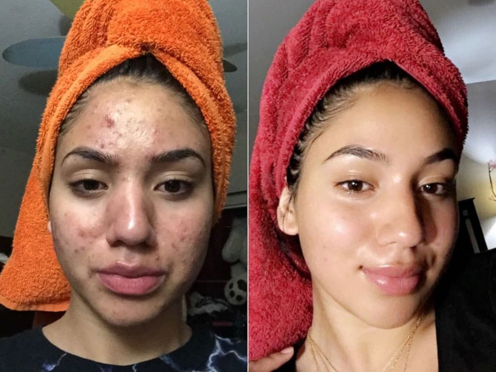 Dr. Melaxin I Glass Skin Essential Kit