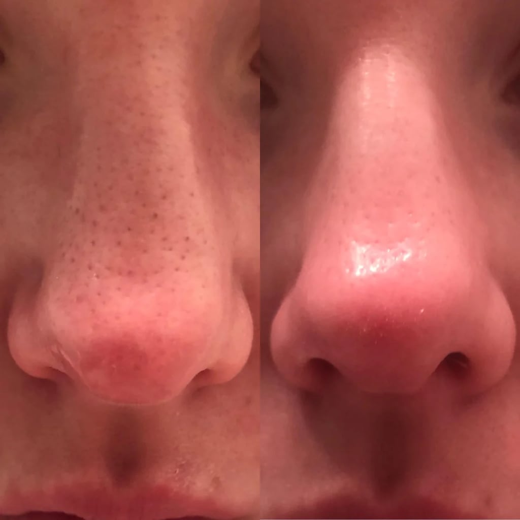 Dr. Melaxin I Glass Skin Essential Kit